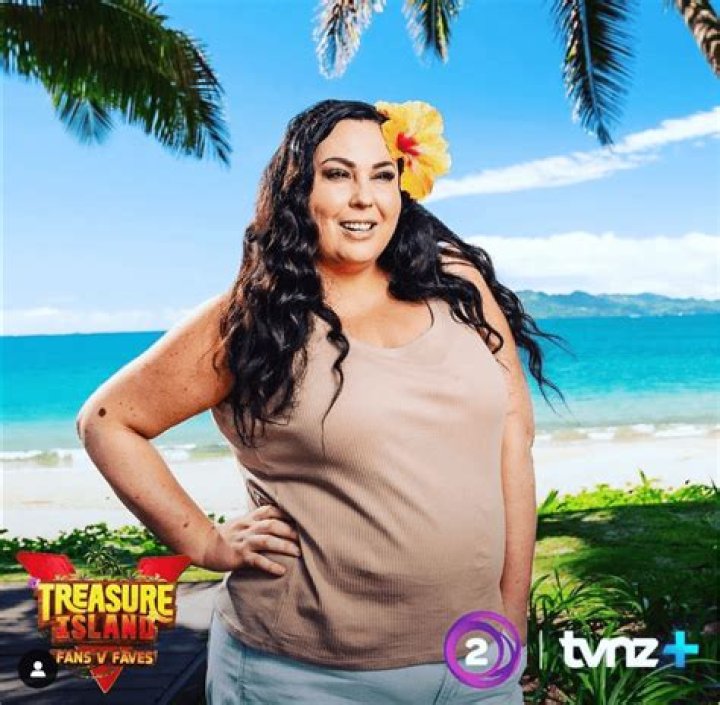 Did Chris Parker Undergo Surgery For Chest Enhancement? Celebrity Treasure Island Star’s Fiance & More