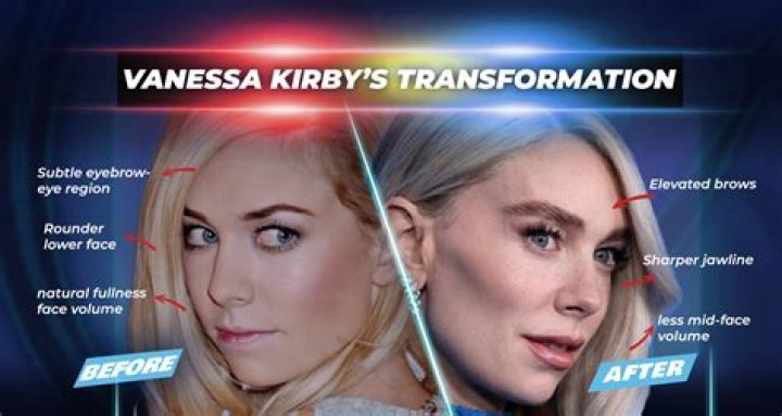 Did Vanessa Kirby Get Plastic Surgery? Her Before and After Photos, Who is Vanessa Kirby? - SarkariResult