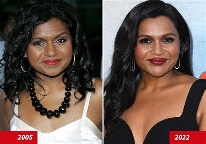 
The Truth About Mindy Kaling Plastic Surgery Rumors 